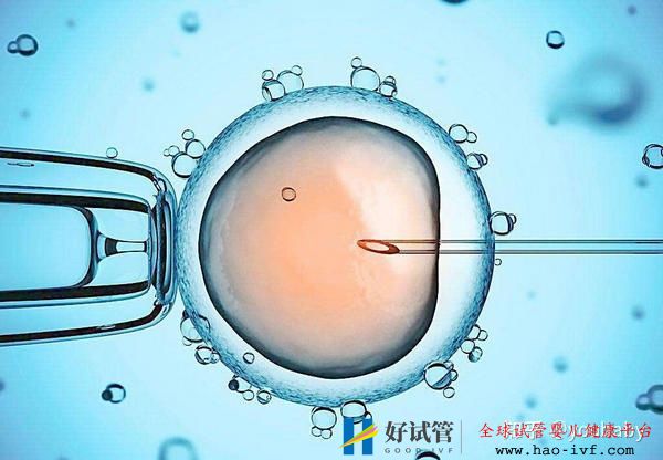 多囊患者做试管婴儿成功的机率大吗看完此篇你就有...(图4) 多囊患者做试管婴儿成功的机率大吗看完此篇你就有...(图4)