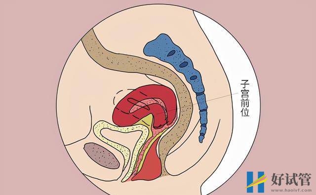 试管婴儿并不是人人都能做,要符合哪些条件?成功后要注意什么?(图1) 试管婴儿并不是人人都能做,要符合哪些条件?成功后要注意什么?(图1)